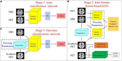 A Hybrid Deep Learning Method for Early and Late Mild Cognitive Impairment Diagnosis With Incomplete Multimodal Data